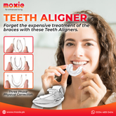 Teeth Aligner